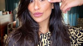 Rita Pereira decidiu mostrar manchas que surgiram na gravidez