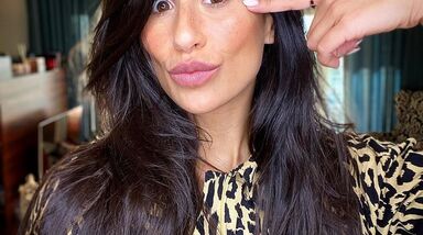 Rita Pereira decidiu mostrar manchas que surgiram na gravidez